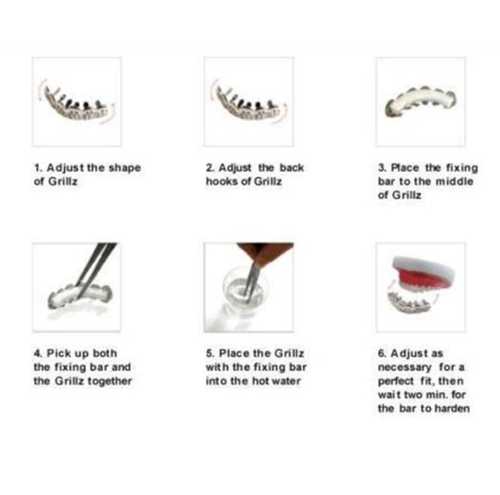 Glip-plated Gold Teeth Braces